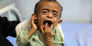 İngiltere İşçi Partisi İngiliz hükumetini Yemenli çocukları katletmekle suçladı